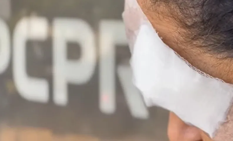 Moradora é agredida e assaltada a caminho do mercado no Conjunto Ouro Branco