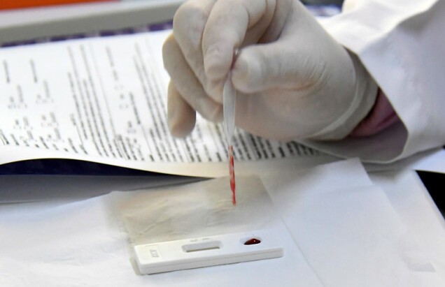 Julho fecha com total de seis casos de Covid e agosto começa com um diagnóstico positivo